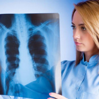 В Троицке увеличилось количество больных туберкулезом