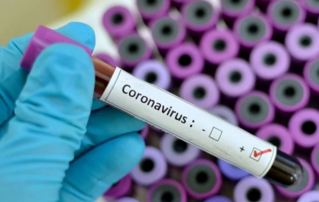 За последние сутки в регионе подтверждено 3 новых случая заражения COVID-19